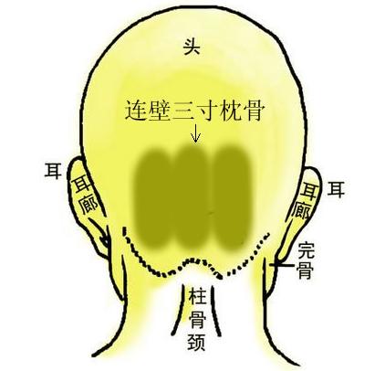 7连璧三寸枕骨